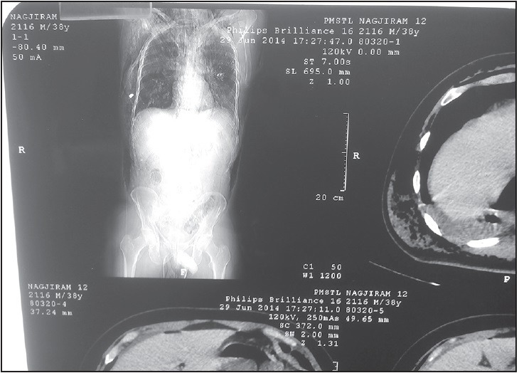 Figure 5