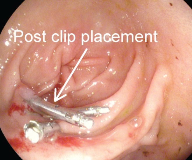 Figure 2)