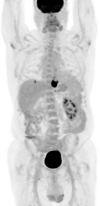 Fig 1: