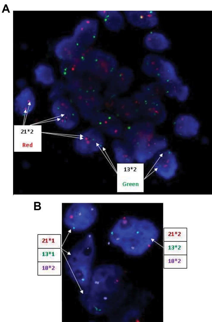 Fig 4