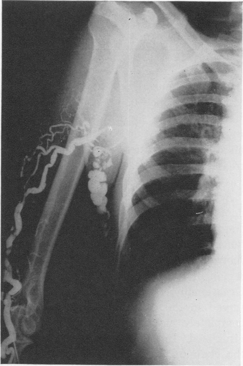 Fig. 3c.