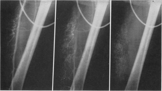 Fig. 2a, Fig. 2b, Fig. 2c.