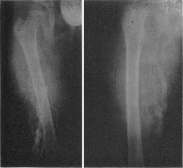 Fig. 9a, 9b.