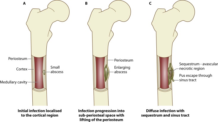 FIG 1