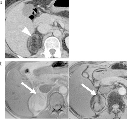 Fig. 2