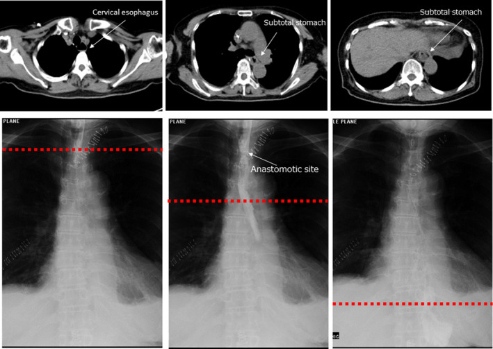 Figure 6