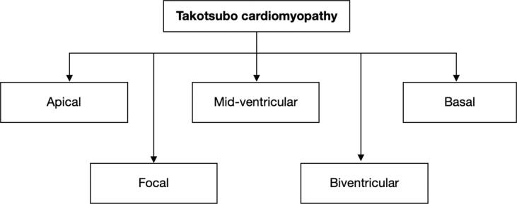 Fig. 1b