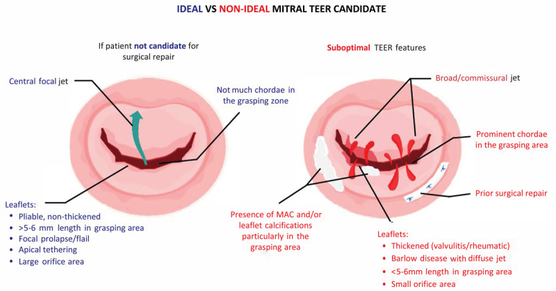 Ideal versus nonideal candidates for TEER.