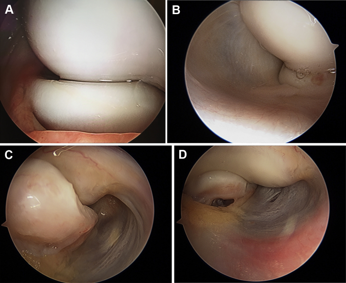 Fig 1