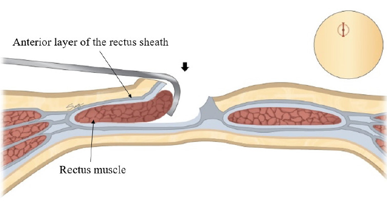 Fig. 3.