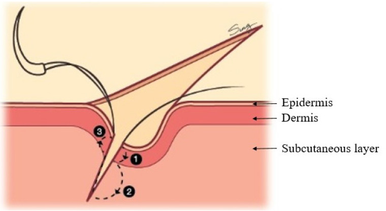 Fig. 6.