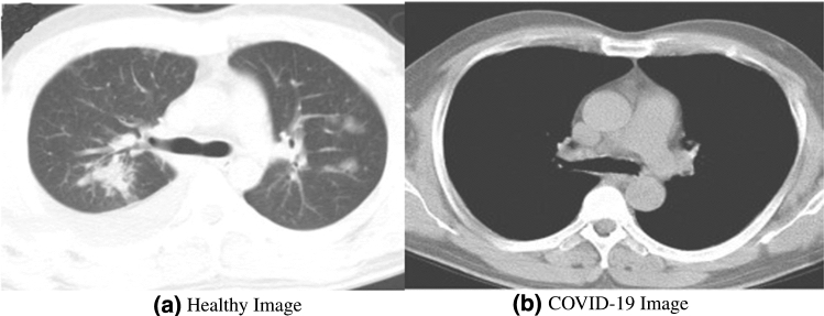 Fig. 19