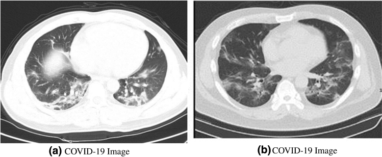 Fig. 20