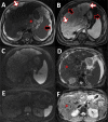 Fig. 9