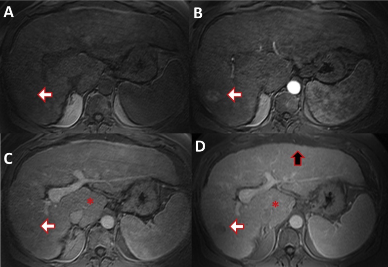 Fig. 10