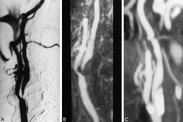 Fig 3.