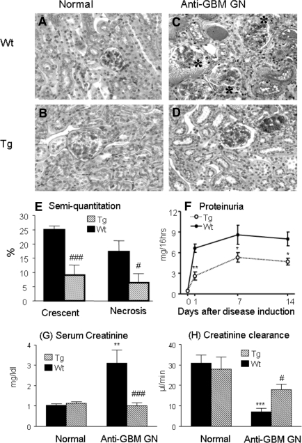 Latent TGF-β1 Protects Against Crescentic Glomerulonephritis - PMC