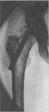 848-2