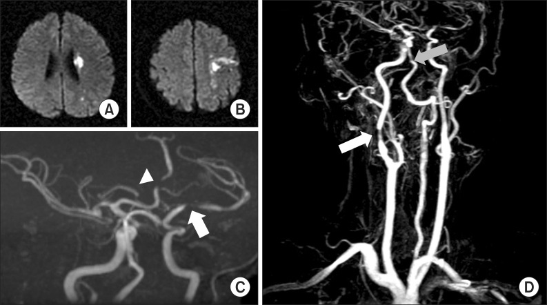 Fig. 1