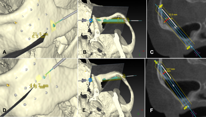 Fig. 6