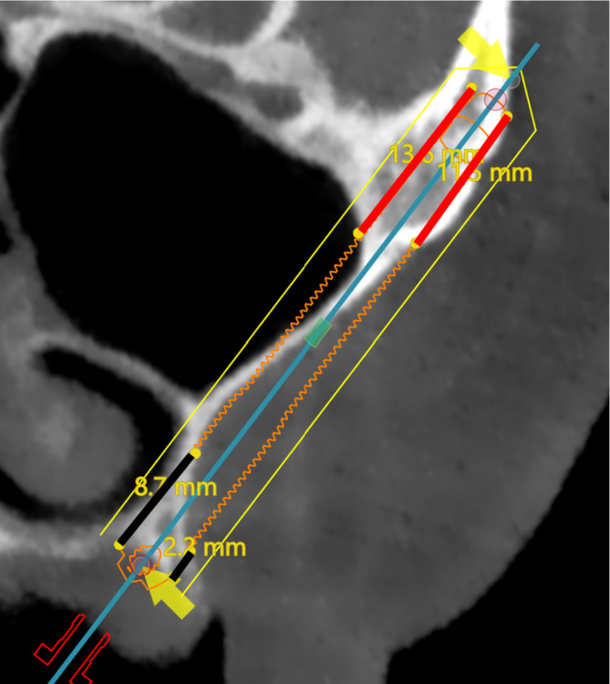 Fig. 5