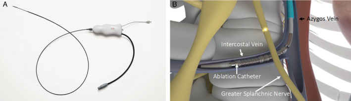 EJHF-2559-FIG-0001-c