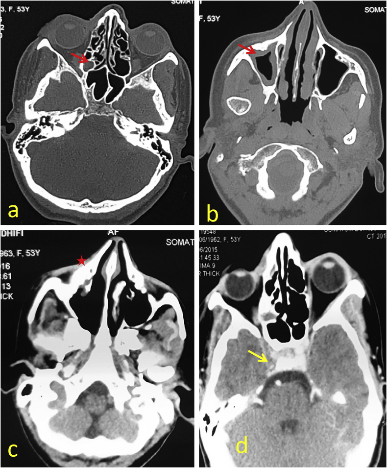 Fig. 6