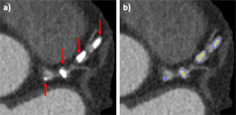 FIG. 3.