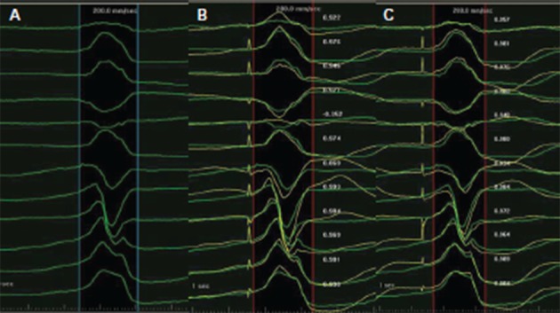 Figure 2: