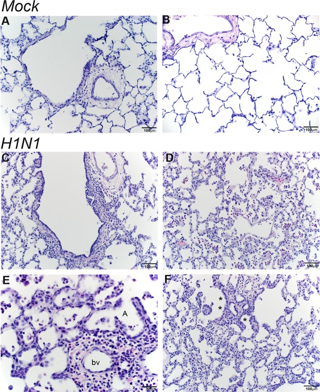 FIG 11