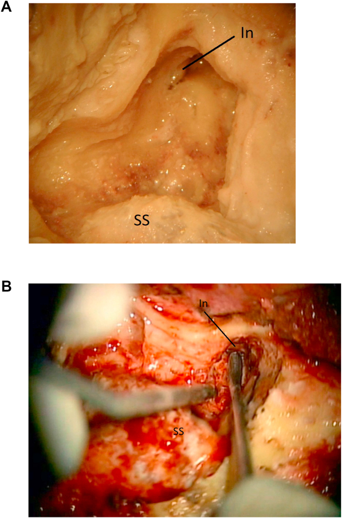 Fig. 4