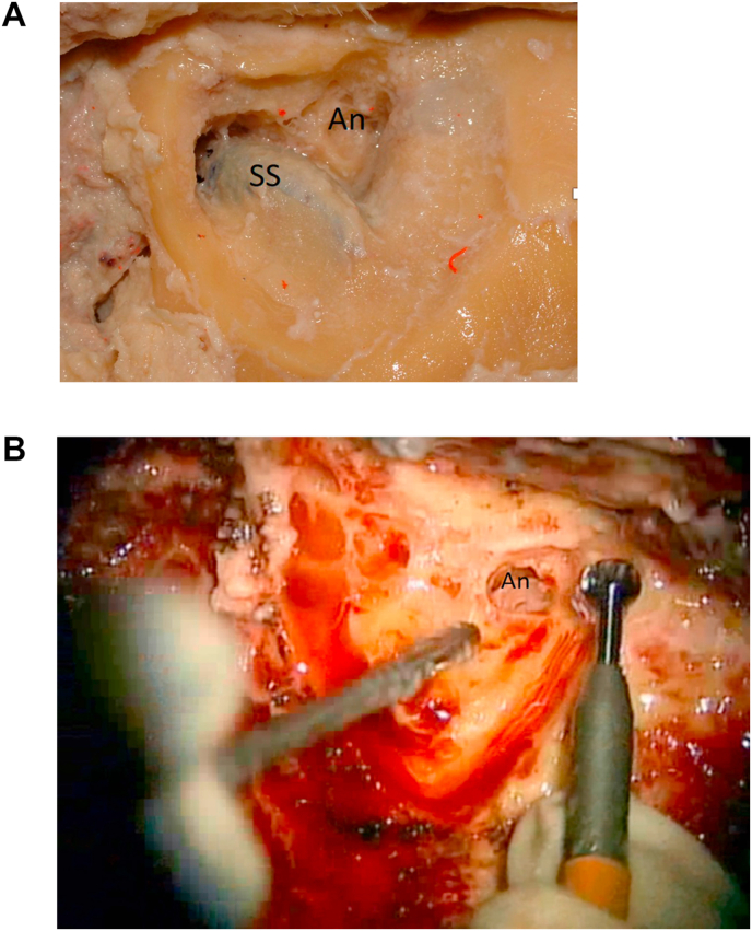 Fig. 3