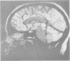 992