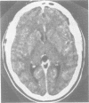 992