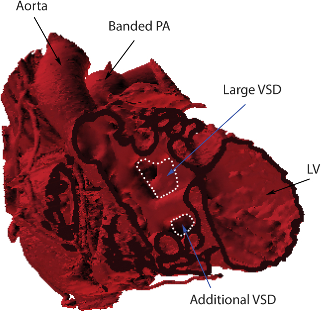 Figure 1