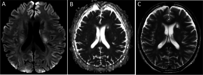 Fig. 2