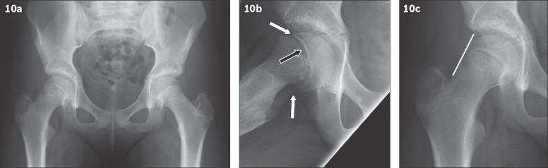 Fig. 10