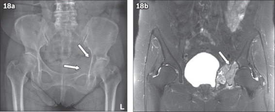 Fig. 18