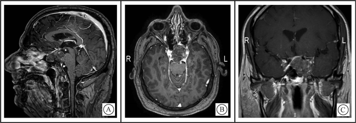 Figure 3