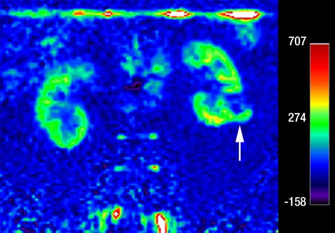 Figure 3c: