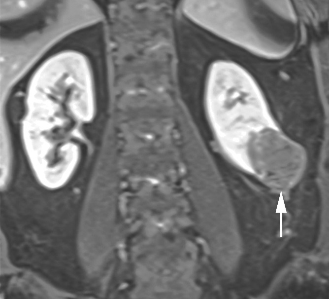 Figure 4b: