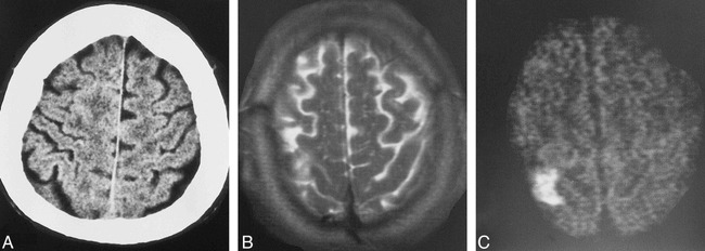 fig 5.