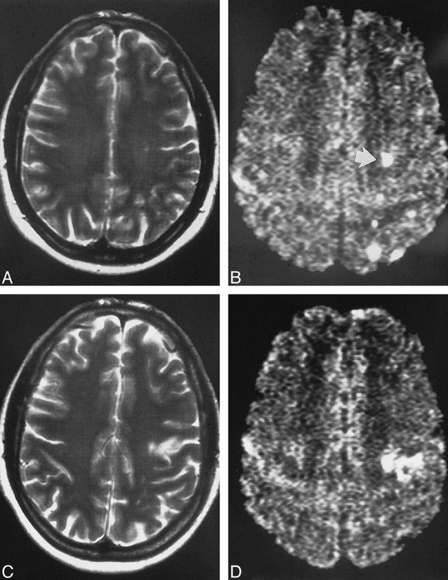 fig 4.