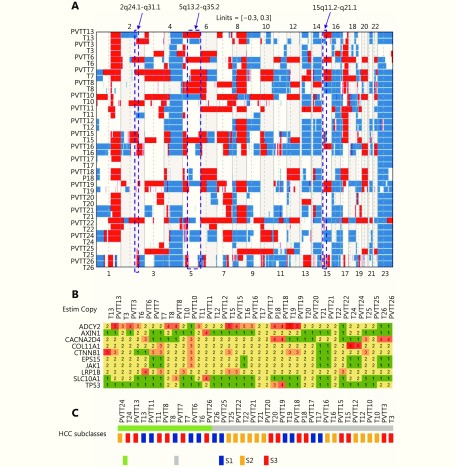 (A) Copy number variations (CNVs) of chromosome regions in PVTTs and corresponding primary Ts. The specific CNV regions in PVTT13 and T13 were labeled by rectangles. The CNV threshold = 0.3; red, gain of CNV; blue, loss of CNV. (B) Copy numbers of HCC driver genes in PVTTs and Ts. (C) Molecular subtype of PVTTs and Ts according to Hoshida S1-S2-S3 classes.