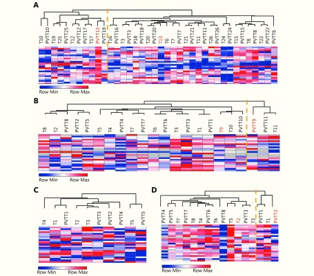 cluster analysis of pairs of PVTTs and Ts from GSE77509 (A), GSE69164 (B), GSE74656 (C), and newly collected samples (D) based on expression of 24 genes assessed by RNA-seq, cDNA microarray, or real time PCR. Orange line indicates the two subgroups classified based on the 24-gene signature.