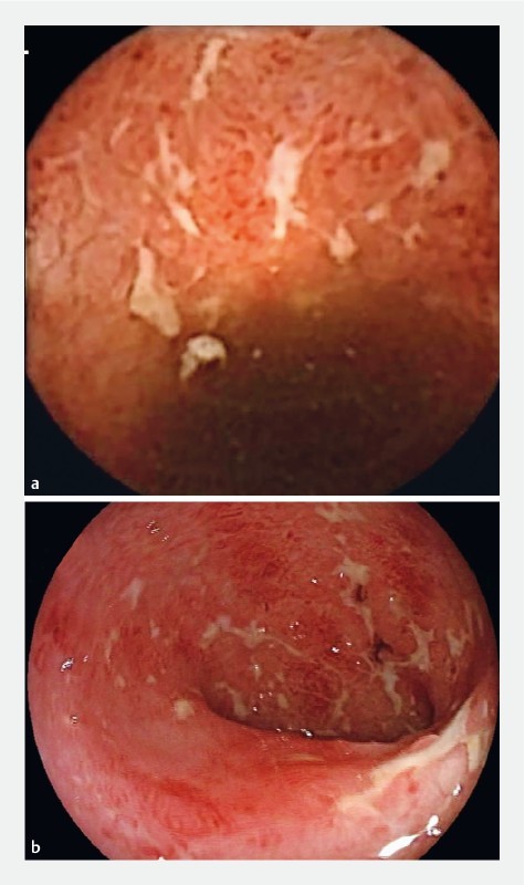 Fig. 2