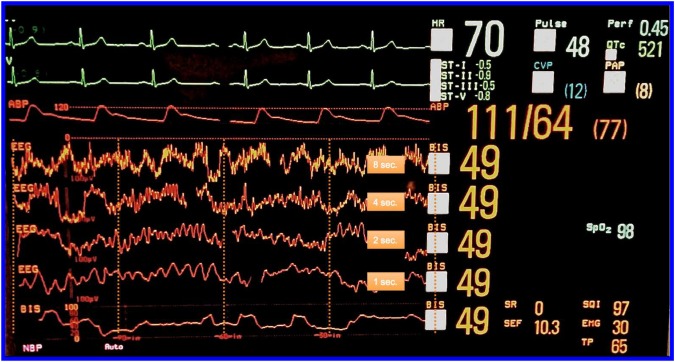 Figure 4