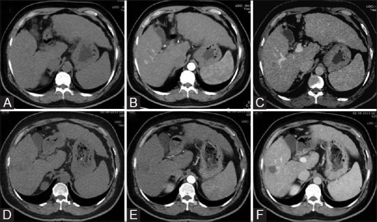 Figure 2(A-F)