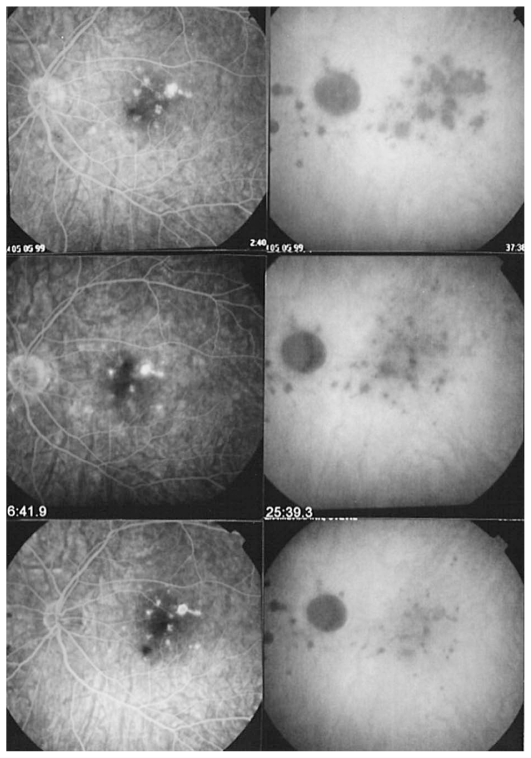 Figure 3C