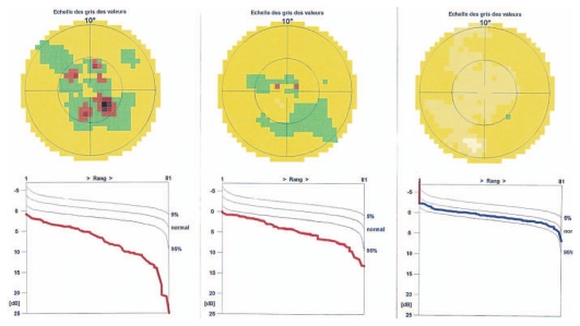 Figure 3B